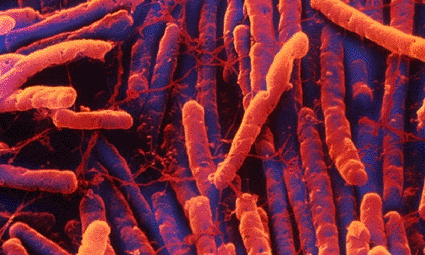 Image: Colored scanning electron micrograph (SEM) of C. difficile bacteria (Photo courtesy of D. Phillips / SPL).